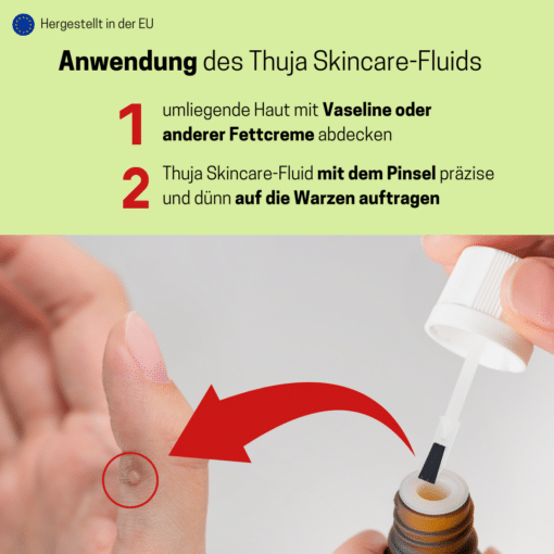 Thuja Medosan Warzenentferner, 10ml mit Dosierpinsel – Bild 2