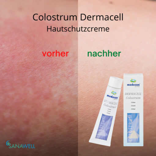 Medosan DermaCell Colostrum Creme für die regenerative Hautpflege – Bild 2