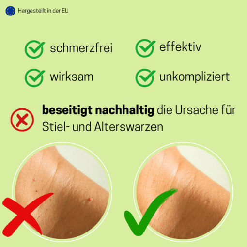 Thuja Medosan Warzenentferner, 10ml mit Dosierpinsel – Bild 4
