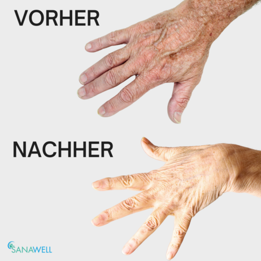 Altersflecken Seife, 1 Stück – Bild 4