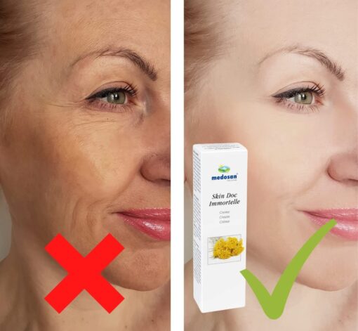 Immortelle Skin Doc Creme – Bild 3