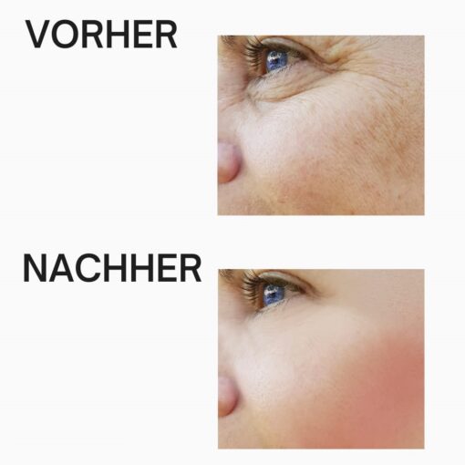 Immortelle Skin Doc Creme – Bild 4