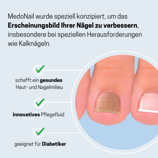 MedoNail Nagelpflegefluid | Natürliche Unterstützung für gesunde Nägel – Bild 3