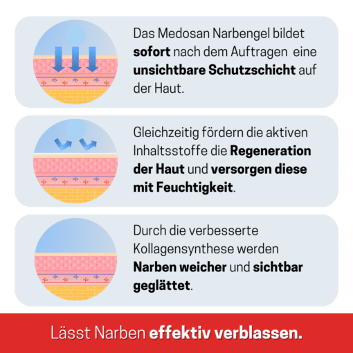 Narbengel | effektive Behandlung von Narben | nach Operationen, Verletzungen, Akne und Hautinfektionen – Bild 3