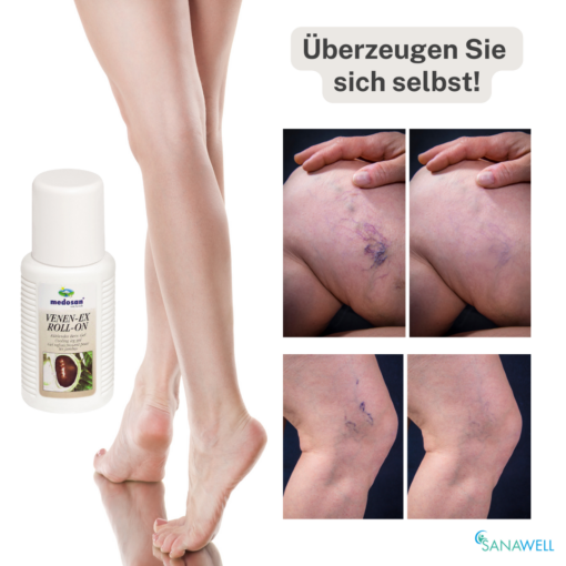 Medosan Hautcreme - Venen-Ex Roll-On – Bild 4